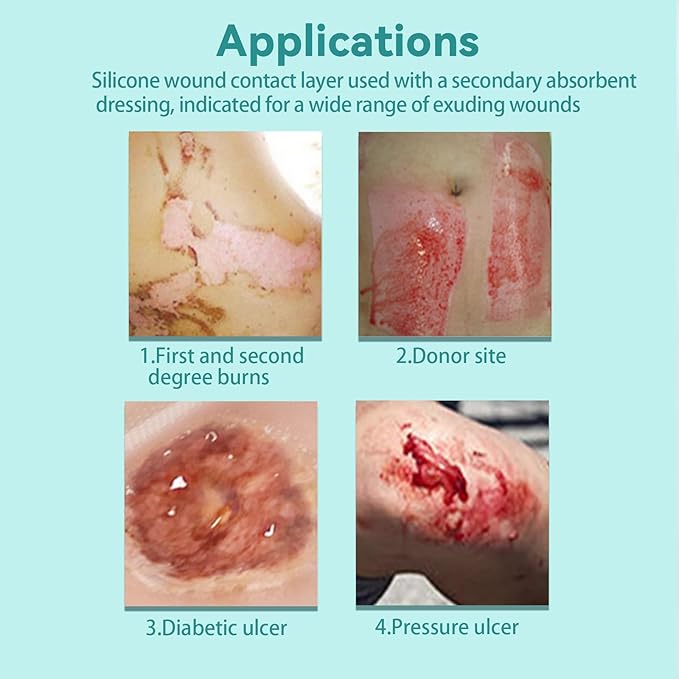 Dimora Silicone Wound Contact Layer, Non-adhering Dressing, Transparent Wound Dressing Pads, 3in x 4in (7.5cm x 10cm), 10 pcs